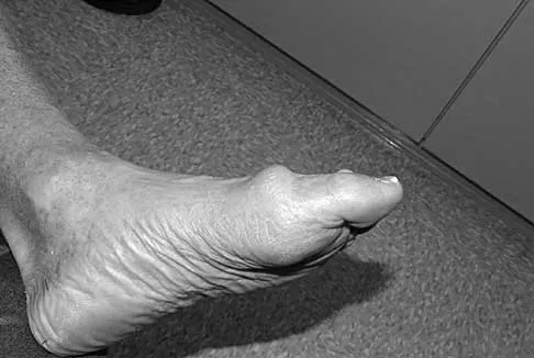 Foot & Ankle 2026 MCQs: Board Review Questions & Answers (Part 1) - Figure 1