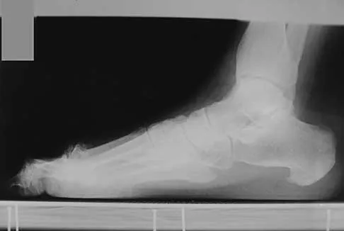 Foot & Ankle 2026 MCQs: Board Review Questions & Answers (Part 1) - Figure 10