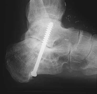 Foot & Ankle 2026 MCQs: Board Review Questions & Answers (Part 1) - Figure 115