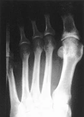 Foot & Ankle 2026 MCQs: Board Review Questions & Answers (Part 1) - Figure 119