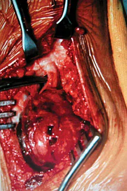 Foot & Ankle 2026 MCQs: Board Review Questions & Answers (Part 1) - Figure 135