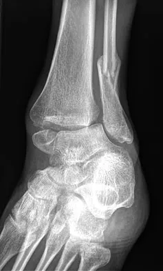 Foot & Ankle 2026 MCQs: Board Review Questions & Answers (Part 1) - Figure 153