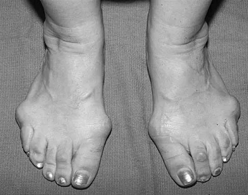 Foot & Ankle 2026 MCQs: Board Review Questions & Answers (Part 1) - Figure 23