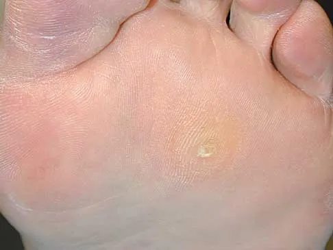 Foot & Ankle 2026 MCQs: Board Review Questions & Answers (Part 1) - Figure 39