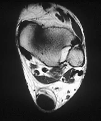 Foot & Ankle 2026 MCQs: Board Review Questions & Answers (Part 1) - Figure 49