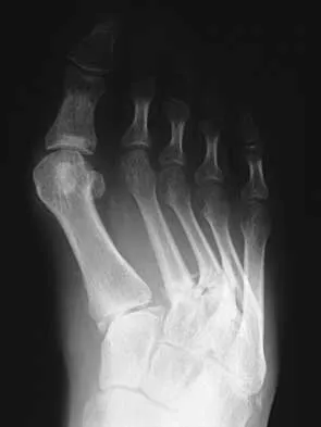 Foot & Ankle 2026 MCQs: Board Review Questions & Answers (Part 1) - Figure 53