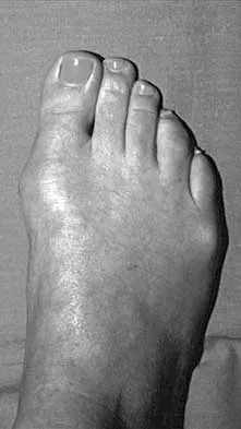 Foot & Ankle 2026 MCQs: Board Review Questions & Answers (Part 1) - Figure 59