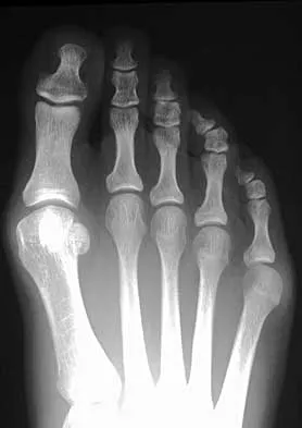 Foot & Ankle 2026 MCQs: Board Review Questions & Answers (Part 1) - Figure 61