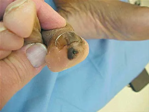 Foot & Ankle 2026 MCQs: Board Review Questions & Answers (Part 1) - Figure 77