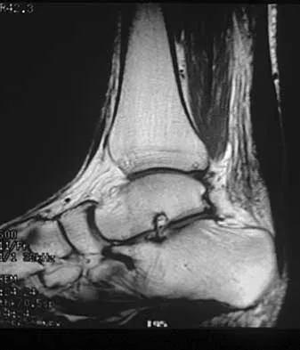 Foot & Ankle 2026 MCQs: Board Review Questions & Answers (Part 1) - Figure 85