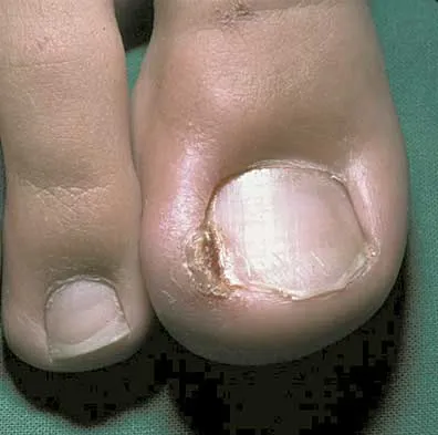 Foot & Ankle 2026 MCQs: Board Review Questions & Answers (Part 1) - Figure 87