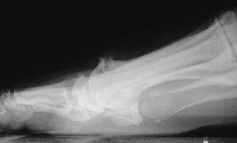 Foot & Ankle 2026 MCQs: Board Review Questions & Answers (Part 1) - Figure 95