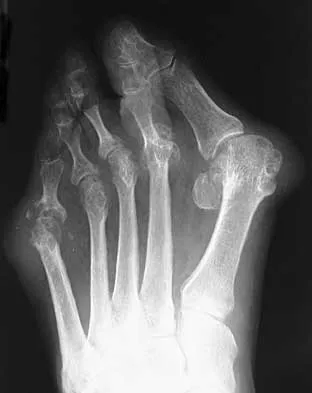 Foot & Ankle 2026 MCQs: Board Review Questions & Answers (Part 2) - Figure 103