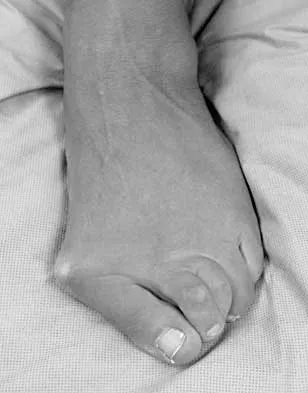 Foot & Ankle 2026 MCQs: Board Review Questions & Answers (Part 2) - Figure 105