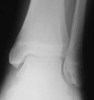 Foot & Ankle 2026 MCQs: Board Review Questions & Answers (Part 2) - Figure 113