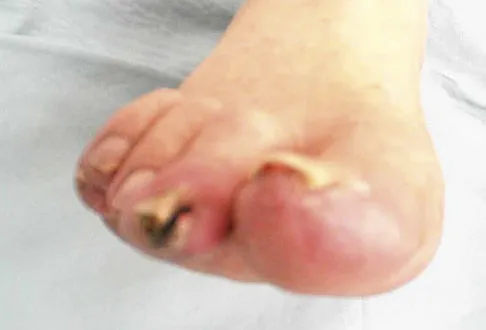 Foot & Ankle 2026 MCQs: Board Review Questions & Answers (Part 2) - Figure 133