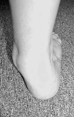 Foot & Ankle 2026 MCQs: Board Review Questions & Answers (Part 2) - Figure 21