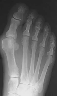 Foot & Ankle 2026 MCQs: Board Review Questions & Answers (Part 2) - Figure 29