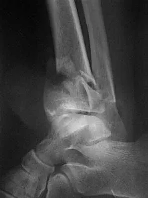 Foot & Ankle 2026 MCQs: Board Review Questions & Answers (Part 2) - Figure 3