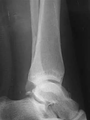 Foot & Ankle 2026 MCQs: Board Review Questions & Answers (Part 2) - Figure 43