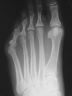 Foot & Ankle 2026 MCQs: Board Review Questions & Answers (Part 2) - Figure 51