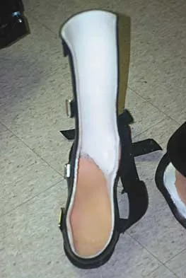 Foot & Ankle 2026 MCQs: Board Review Questions & Answers (Part 2) - Figure 63