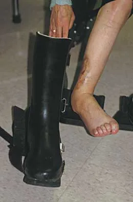 Foot & Ankle 2026 MCQs: Board Review Questions & Answers (Part 2) - Figure 65