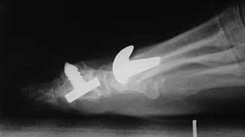 Foot & Ankle 2026 MCQs: Board Review Questions & Answers (Part 2) - Figure 69