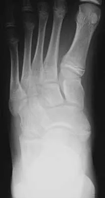 Foot & Ankle 2026 MCQs: Board Review Questions & Answers (Part 2) - Figure 71