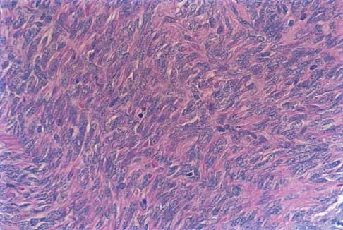 Foot & Ankle 2026 MCQs: Board Review Questions & Answers (Part 2) - Figure 81