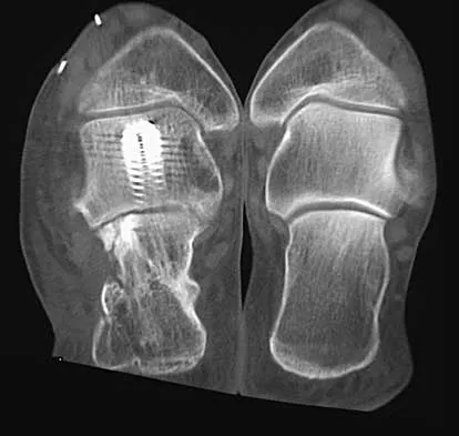 Foot & Ankle 2026 MCQs: Board Review Questions & Answers (Part 2) - Figure 85