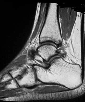 Foot & Ankle 2026 MCQs: Board Review Questions & Answers (Part 2) - Figure 97