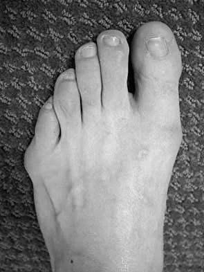 Foot & Ankle 2026 MCQs: Board Review Questions & Answers (Part 3) - Figure 25