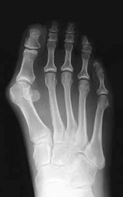 Foot & Ankle 2026 MCQs: Board Review Questions & Answers (Part 3) - Figure 33