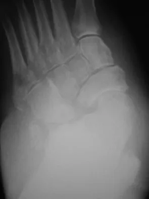 Foot & Ankle 2026 MCQs: Board Review Questions & Answers (Part 3) - Figure 41