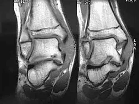 Foot & Ankle 2026 MCQs: Board Review Questions & Answers (Part 4) - Figure 19