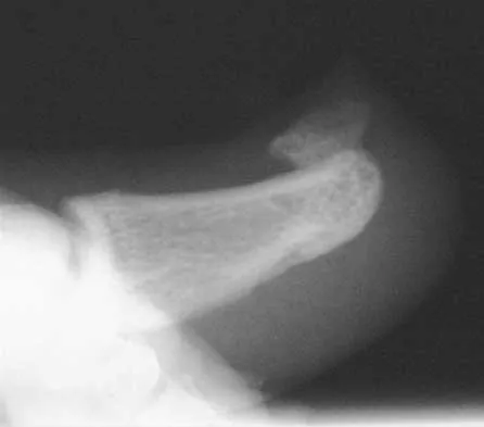 Foot & Ankle 2026 MCQs: Board Review Questions & Answers (Part 4) - Figure 41