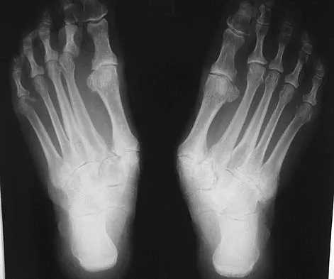 Foot & Ankle 2026 MCQs: Board Review Questions & Answers (Part 4) - Figure 47