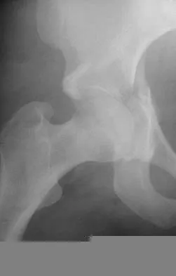 General Orthopedics 2026 Practice Questions: Set 19 (Solved) Figure 1