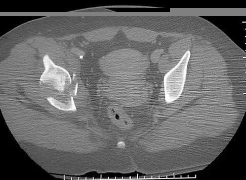 General Orthopedics 2026 Practice Questions: Set 19 (Solved) Figure 2