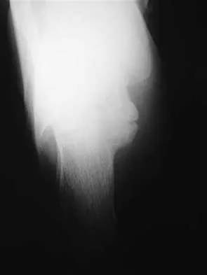 General Orthopedics 2026 Practice Questions: Set 1 (Solved) - Figure 11