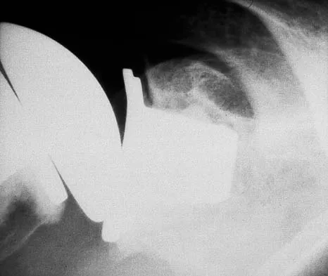 General Orthopedics 2026 Practice Questions: Set 1 (Solved) - Figure 13
