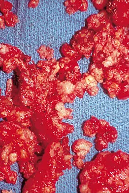 General Orthopedics 2026 Practice Questions: Set 1 (Solved) - Figure 16