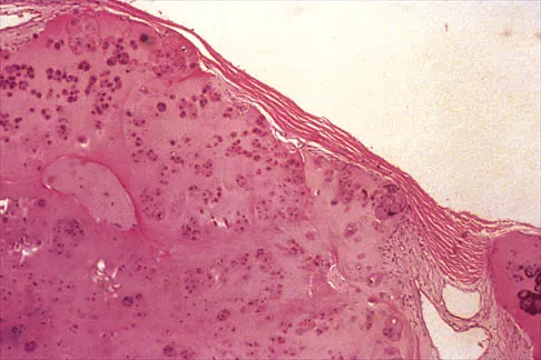 General Orthopedics 2026 Practice Questions: Set 1 (Solved) - Figure 17