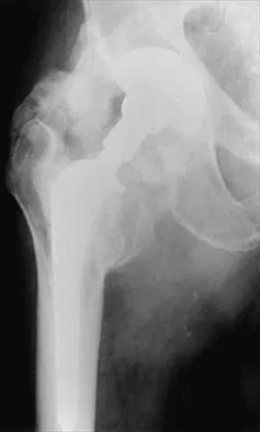 General Orthopedics 2026 Practice Questions: Set 1 (Solved) - Figure 26