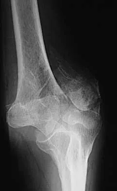 General Orthopedics 2026 Practice Questions: Set 1 (Solved) - Figure 32