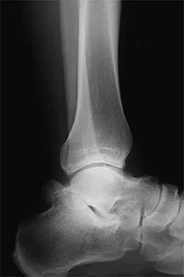 General Orthopedics 2026 Practice Questions: Set 1 (Solved) - Figure 42