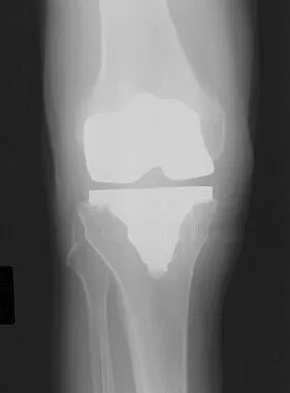 General Orthopedics 2026 Practice Questions: Set 1 (Solved) - Figure 48