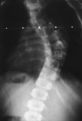 General Orthopedics 2026 Practice Questions: Set 1 (Solved) - Figure 5