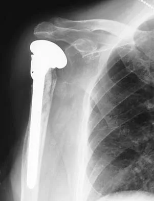 General Orthopedics 2026 Practice Questions: Set 1 (Solved) - Figure 50